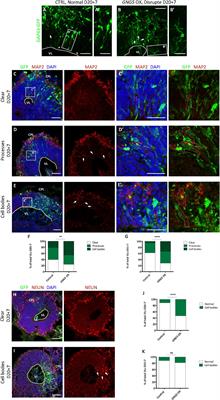 GNG5 Controls the Number of Apical and Basal Progenitors and Alters Neuronal Migration During Cortical Development